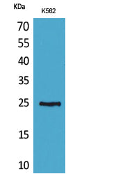CD7 Rabbit Polyclonal Antibody