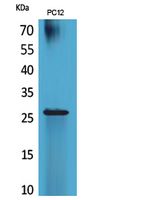 RNA Polymerase III Subunit C7 Rabbit Polyclonal Antibody