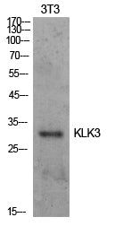 Prostate Specific Antigen Rabbit Polyclonal Antibody