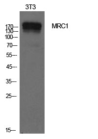 Mannose Receptor Rabbit Polyclonal Antibody