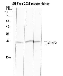 TP53INP2 Rabbit Polyclonal Antibody