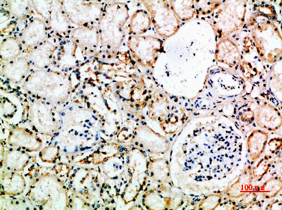 CD16 Rabbit Polyclonal Antibody