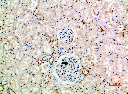 IL-18 Receptor Accessory Protein Rabbit Polyclonal Antibody