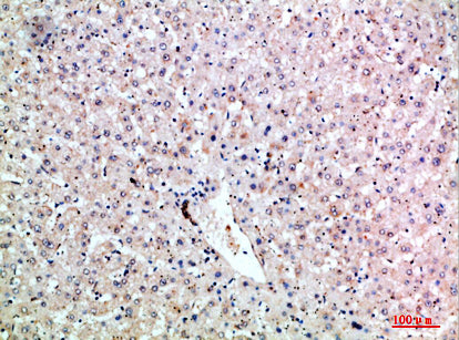 LTB Rabbit Polyclonal Antibody