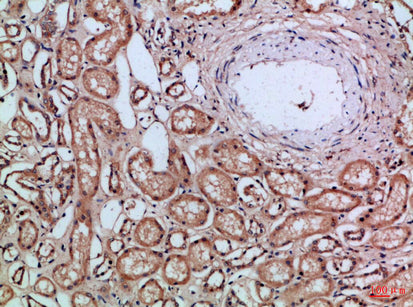 CD66a/b/c Rabbit Polyclonal Antibody