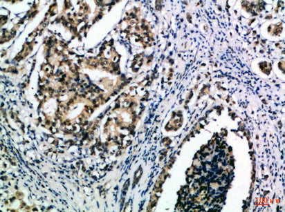 IL-15 Rabbit Polyclonal Antibody