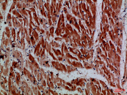 MYH6/7 Rabbit Polyclonal Antibody