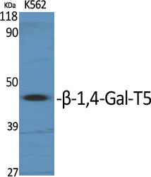 B4GALT5 Rabbit Polyclonal Antibody