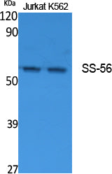 TRIM68 Rabbit Polyclonal Antibody