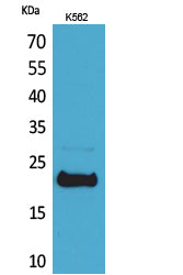LIF Rabbit Polyclonal Antibody