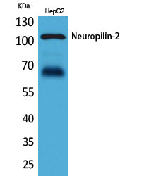 Neuropilin 2 Rabbit Polyclonal Antibody