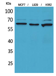 CD73 Rabbit Polyclonal Antibody