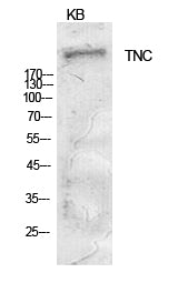 Tenascin Rabbit Polyclonal Antibody