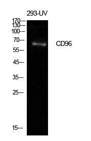CD96 Rabbit Polyclonal Antibody