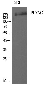 CD232 Rabbit Polyclonal Antibody