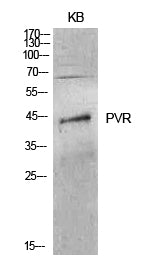 CD155 Rabbit Polyclonal Antibody