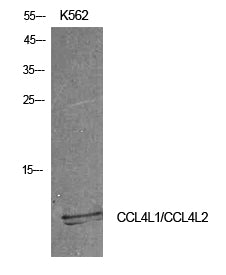 CCL4L Rabbit Polyclonal Antibody