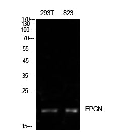 Epigen Rabbit Polyclonal Antibody