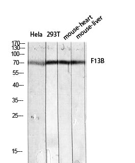 Factor XIII Rabbit Polyclonal Antibody