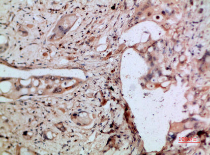 ENA 78 Rabbit Polyclonal Antibody