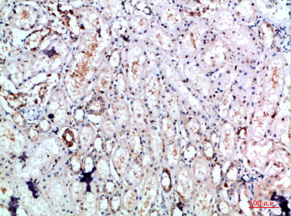 DLEU7 Rabbit Polyclonal Antibody