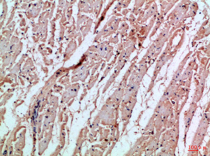 MIA Rabbit Polyclonal Antibody