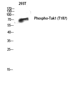 Phospho-TAK1 (Thr187) Rabbit Polyclonal Antibody