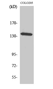 ALPK1 Rabbit Polyclonal Antibody