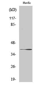beta 3 Gal T1 Rabbit Polyclonal Antibody