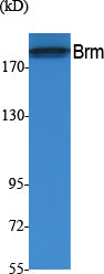 BRM Rabbit Polyclonal Antibody