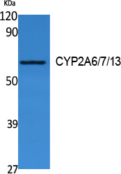 Cytochrome P450 2A6/7/13 Rabbit Polyclonal Antibody