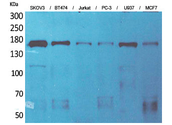 Synaptonemal Complex Protein 2 Rabbit Polyclonal Antibody