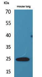 Endothelin 1 Rabbit Polyclonal Antibody