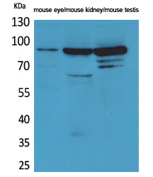 HGS Rabbit Polyclonal Antibody