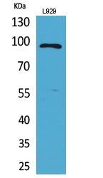 MACC1 Rabbit Polyclonal Antibody