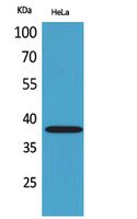 KIR2DL2/3 Rabbit Polyclonal Antibody
