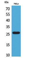 DCL-1 Rabbit Polyclonal Antibody