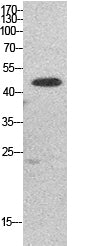 Elongation Factor 1A1/2/P5 Rabbit Polyclonal Antibody