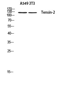 Tensin 2 Rabbit Polyclonal Antibody