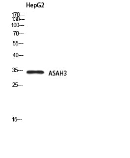 ASAH3 Rabbit Polyclonal Antibody