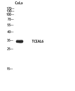TCEAL6 Rabbit Polyclonal Antibody