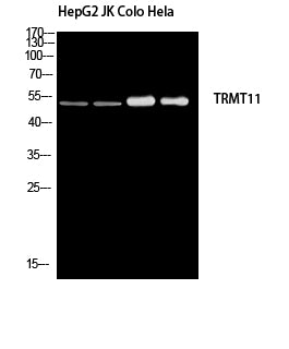 TRMT11 Rabbit Polyclonal Antibody