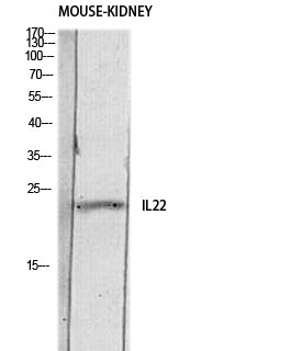 IL-22 Rabbit Polyclonal Antibody