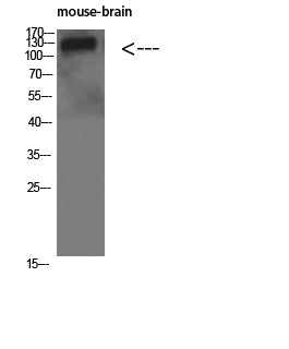 Collagen IV alpha 1 Rabbit Polyclonal Antibody