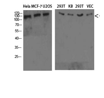 Collagen IV alpha 1 Rabbit Polyclonal Antibody