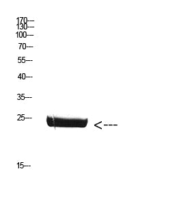 Placental Lactogen Rabbit Polyclonal Antibody