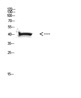 HLA A Rabbit Polyclonal Antibody