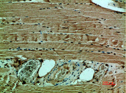 Collagen XII alpha 1 Rabbit Polyclonal Antibody