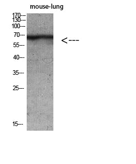 Cytokeratin Rabbit Polyclonal Antibody