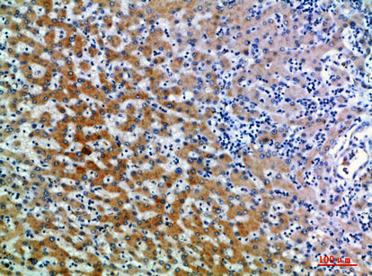 CD109 Rabbit Polyclonal Antibody